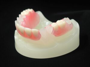 入れ歯　自費診療